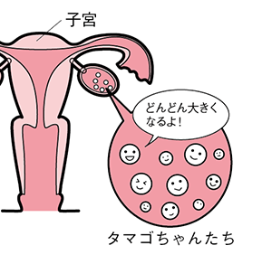 排卵誘発