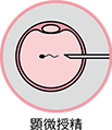 顕微授精(ICSI）